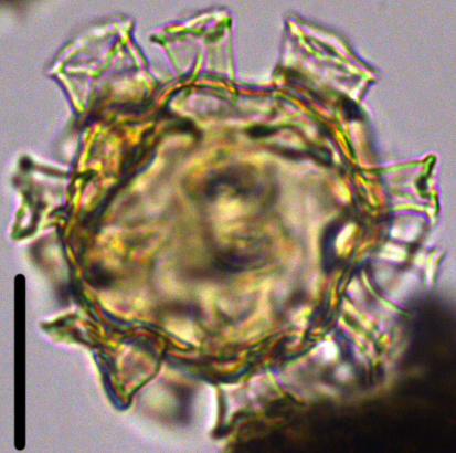 Hystrichosphaeridium tubiferum 3 HtuR27X35050235975b.jpg